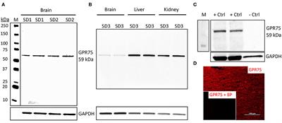 20-HETE Enzymes and Receptors in the Neurovascular Unit: Implications in Cerebrovascular Disease